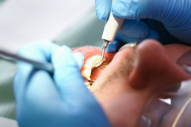 Best Urgent Care for Lost Fillings or Crowns in Aurora, MO