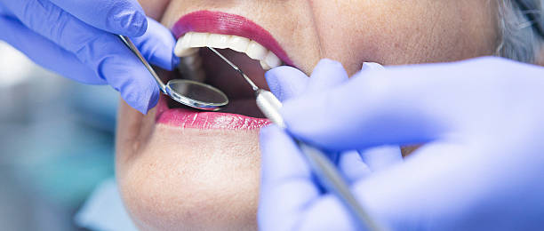 Best Emergency Gum Treatment in Aurora, MO